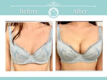 美人バスト 渋谷店/【バストアップ・育乳】症例☆