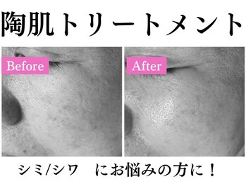 マイン(mine)/陶肌トリートメント