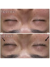 ユウ 尾張旭店(U)/エンビロンビタミンA導入