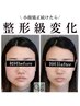★オープンキャンペーン★小顔矯正施術＆美肌美顔器コース11,000円→5,500円