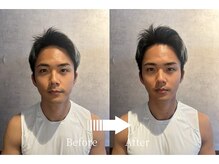 オアシス 谷中銀座 日暮里店/KAWARU小顔矯正