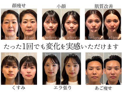 ミトノウ(MITONOU)の写真