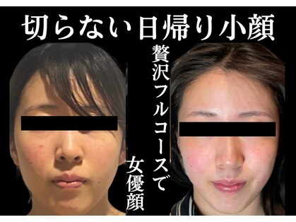 リュクシー(LuxeY)の写真