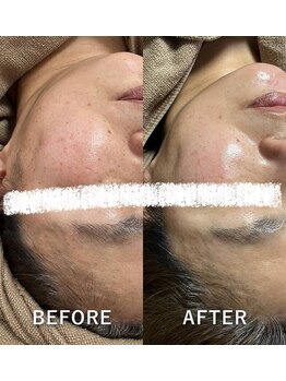 リュミエール(Lumiere)/なかったことに！