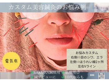 ミエリア美容鍼灸院(mielia美容鍼灸院)/★カスタム電気美容鍼灸の特徴