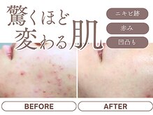 ハーティ