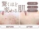 ハーティの写真