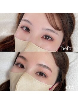 ダリ(Dali)/ハリウッドブロウリフト