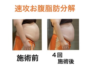 鍼灸サロンオランジュ 高槻富田院/
