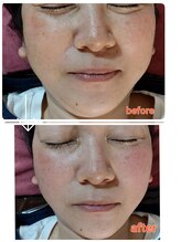 エアレ(eare)/お顔、スリムムーヴ