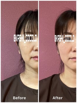 ココロ(CoCoLo)/ビフォーアフター