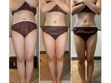 フォビィサロン(FOBE...salon)