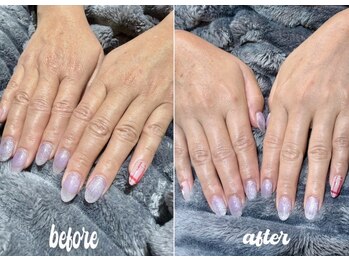 イーム(eam)/ハンドスペシャルケアコース