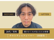 キレイ 筑紫野原田店(KIREI)/20代　顔のむくみが気になる