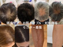 テセラ(Tethere)の雰囲気（モニター募集！通常よりお安くできます。詳細はブログへ）