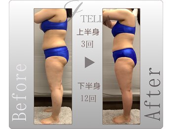 ステラ(STELLA)/上半身、下半身プレミアムの効果