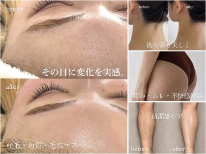 トリア(Tria.)の写真