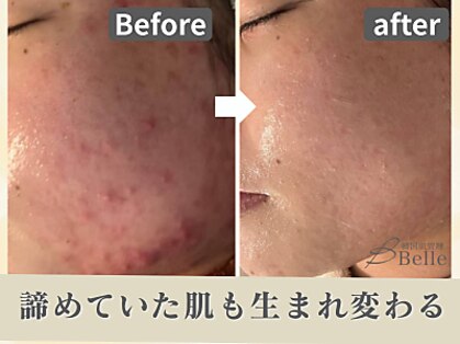 ベル 小倉(Belle)の写真