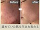 ベル 小倉(Belle)の写真