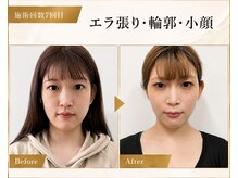 サロンチオリ 烏丸(Salon Chiori)