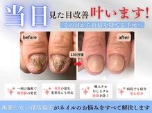 ブルームーンネイルズ(BLOOMOON.nails)