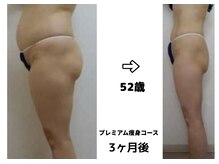 エステ&ビューティストレッチ プチルポの雰囲気（チケット全てに使用期限はありません。ご都合に合わせて使えます）