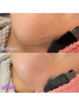 ダイア(DIA)/☆フェイシャルWax効果☆