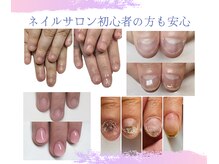 アリー(ali'i)の雰囲気（どんなお悩みもご相談ください！最適な施術方法で美爪に導きます）