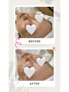 ペイジ(page)/【ララピール】before→after