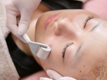 ミエリア美容鍼灸院(mielia美容鍼灸院)/マイクロニードル（肌質改善鍼）