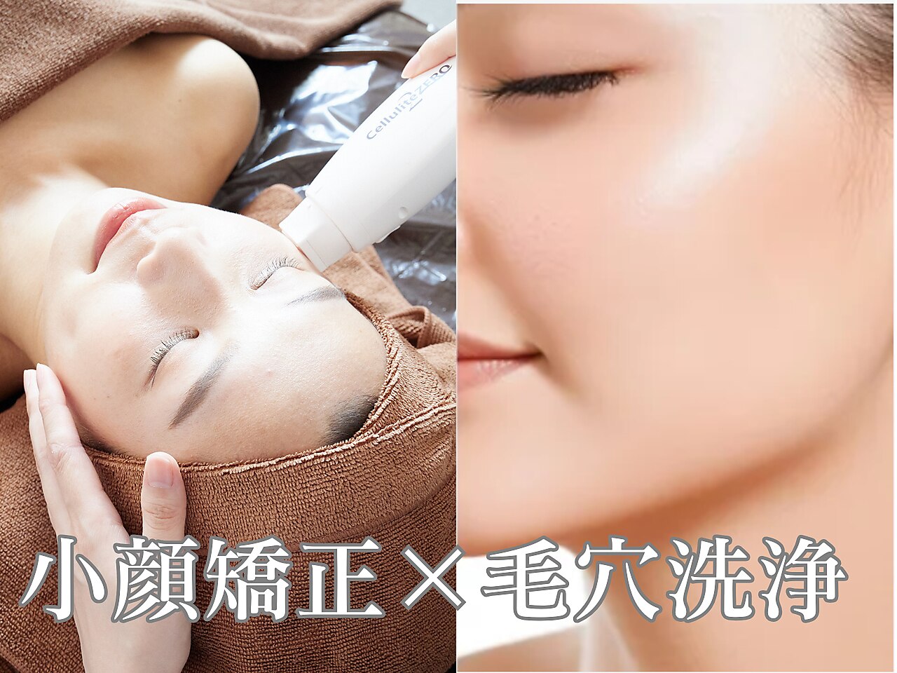 【美肌と小顔が一度に叶う！】毛穴徹底洗浄+小顔矯正 \6000