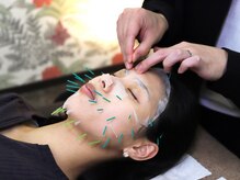 アレイズ(Alaise)