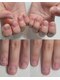エムユーファイブネイル(MU5-nail)の写真/長年の悩みを解消しませんか？深爪矯正★長さだし技術で爪の悩みを解消します!甘皮・ささくれも綺麗に♪