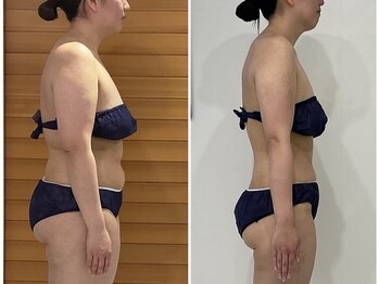 ゴーグ(gog)の写真/《 人生初現在49kg目指している最中》20代後半154cm・体重72.6kg→56.9kg【4ヶ月-15.7kgに成功】