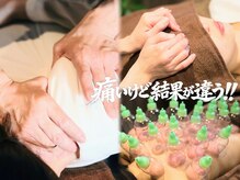 整体ソエルテ(Soerute)