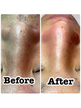 オム ボーテ(Homme Beaute)/フェイシャルワックス