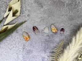 初回ソフトジェルオフ込15000円