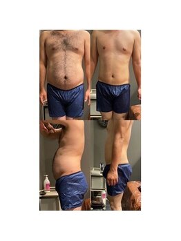 アネル オム 新都心店(ANEL HOMME)/メンズ脱毛+ダイエットマシン!