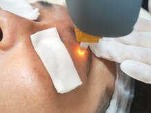 ウェルネスマルカ(wellness MARCA)/眉下脱毛