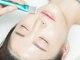 スプレミア(spuremia)の写真/【最新★韓国肌管理】県内希少《ラミネーションピール》艶肌/毛穴ケア/シワ改善にも◎若々しい印象のお肌へ
