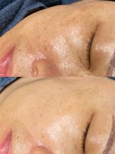 ソリッジ肌管理室/シミケア・くすみケア