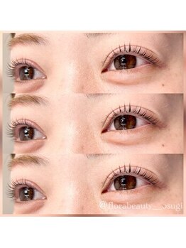 フローラビューティ(Flora Beauty)/ラッシュリフト/まつげパーマ