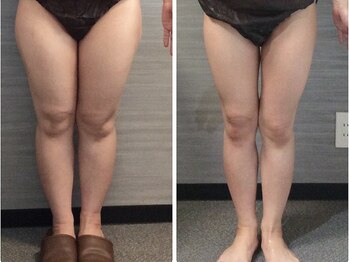 美容整体ウェリナ あま甚目寺院/小顔矯正/骨盤矯正/美脚サロン