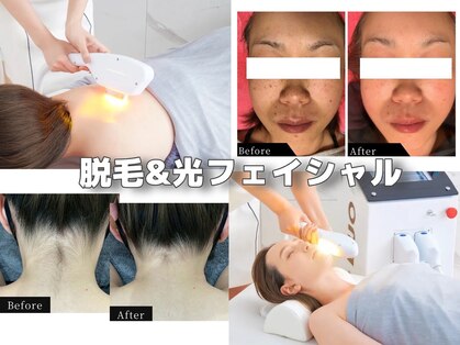 クインティナ(Quintina)の写真