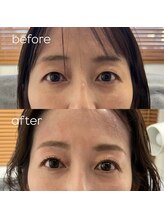 メロー(MELLOW)/まつ毛＋ドライヘッドスパ