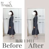 トライム(Trime)
