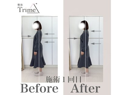 トライム(Trime)の写真