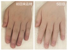 キレイテ 上野店/30代/5回目【ハンドケア稲荷町】