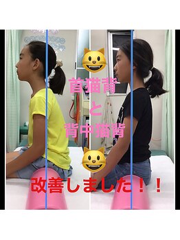 こころ整骨院 こころ鍼灸院/子供の猫背矯正