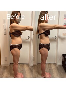 シエル 春日部店(Ciel)/ビフォーアフター